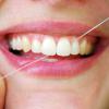 Plaque dentaire et alimentation - Les aliments à éviter ou privilégier en cas de plaque bactérienne. La plaque dentaire, parfois également appelée la plaque bactérienne, est composée de protéines salivaires, de bactéries, de toxines et de résidus...