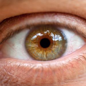 traitement naturel Glaucome et tension oculaire