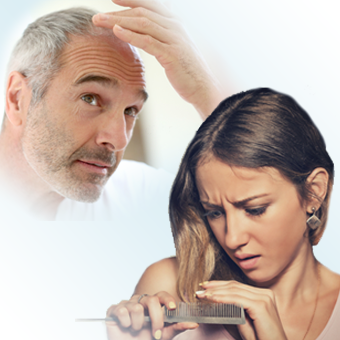 Traitement Naturel Chute De Cheveux L Alopecie Ou La Calvitie Votresanteaunaturel Info